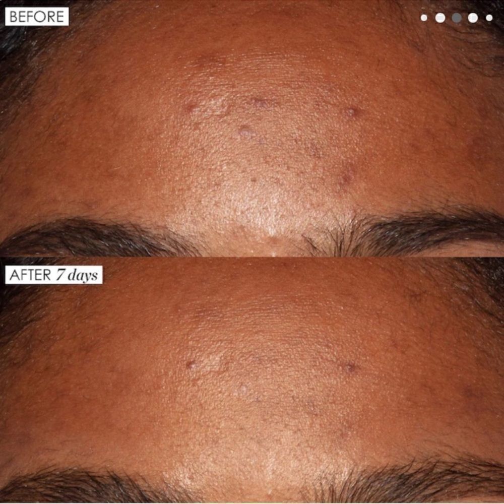 Sunday Riley Good Genes All-In-One Lactic Acid Treatment - Picture 5 of 9